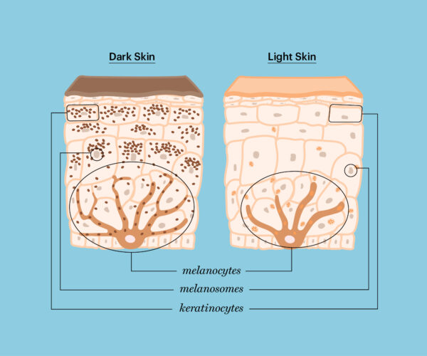 Are People Of Color At Risk For Skin Cancer The Skin Cancer Foundation