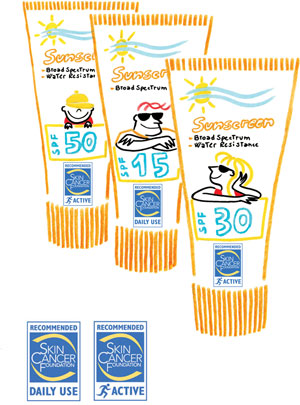 Sunburn and sun protection - treatments and prevention including