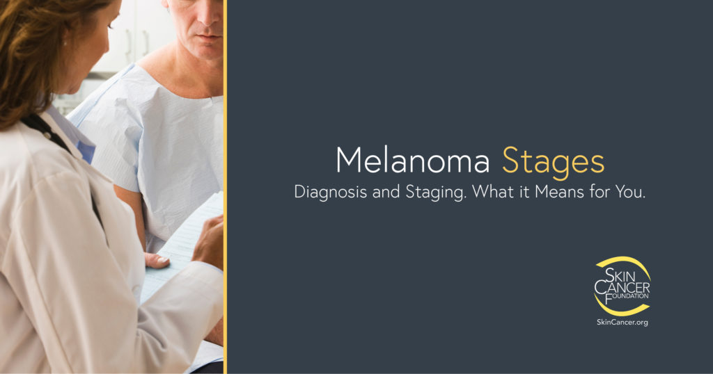 Stages Of Melanoma Chart